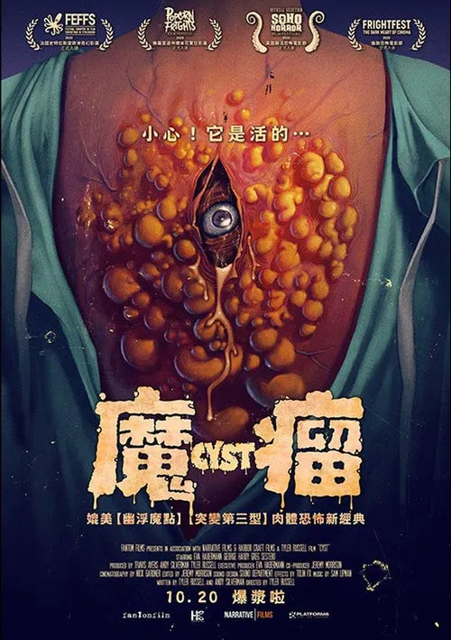 囊肿海报